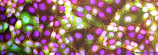 Triple staining rotavirus infected cells Triple staining rotavirus infected cells